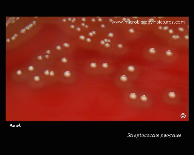 streptococcus pyogenes (group A) colonies on agar with sheep blood